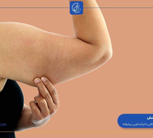 when-does-sagging-skin-start-after-gastric-sleeve-surgery