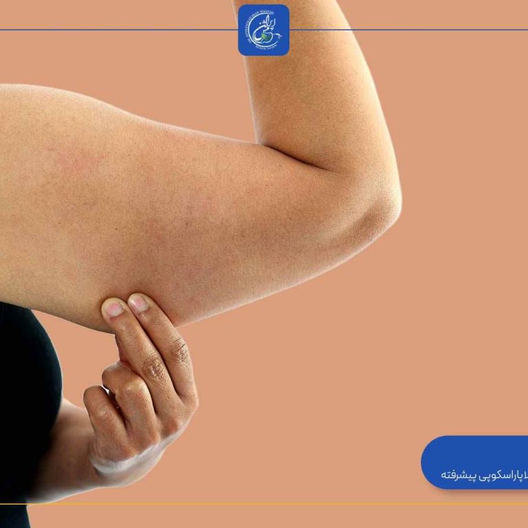 when-does-sagging-skin-start-after-gastric-sleeve-surgery when-does-sagging-skin-start-after-gastric-sleeve-surgery