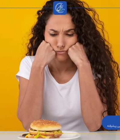 افسردگی بعد از عمل اسلیو معده